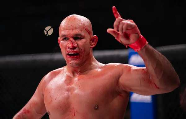 junior-cigano-fica-com-o-nariz-aberto-e-depois-leva-pontos.-veja-como-ficou-–-globo